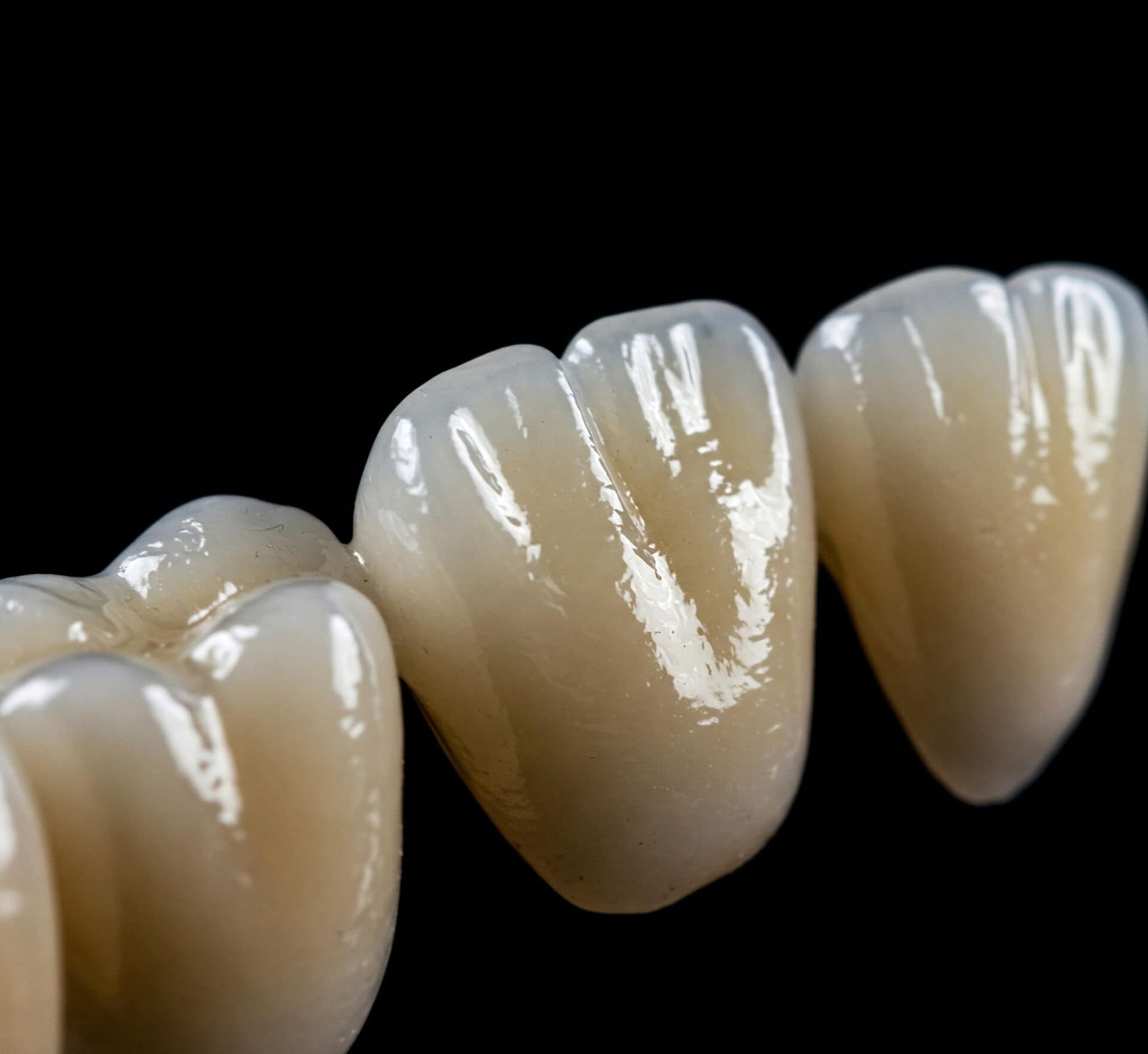 Lake Stevens Dental — Dental clinic in Lake Stevens, WA — photo 5